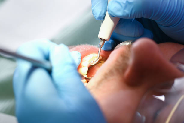 Best Emergency Dental Surgery in Harmony, RI