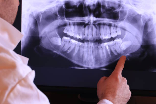 Best Emergency Tooth Extraction in Harmony, RI