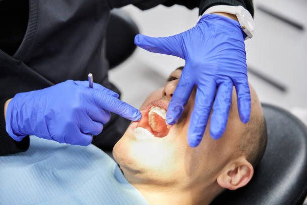 Best Emergency Tooth Extraction in Harmony, RI