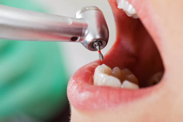 Fast & Reliable Emergency Dental Services in RI